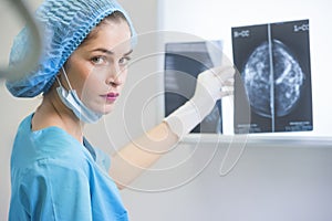 A woman doctor or nurse in surgery outfit is holding a mammogram photo