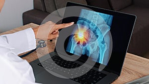 Woman Doctor showing x-ray with pain in the hip side on a laptop. Left to right shot
