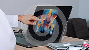 Woman Doctor showing x-ray with pain in the hips and spine on a laptop. Left to right shot