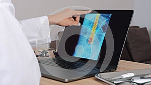 Woman Doctor showing x-ray with pain on the spine on a laptop. Slow motion from Left to Right