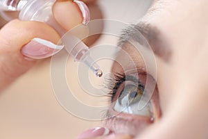 Woman drips eye drops into her eyes photo