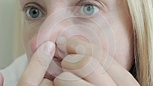 Woman examines her fase and looking for pimples in a mirror and squizing them out, close up