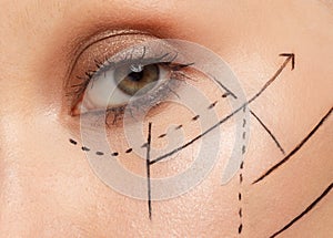 Woman eye area with perforation lines, platic surgery concept