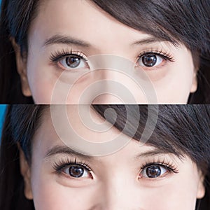 Woman eye bags photo