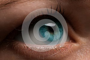 Woman eye with contact lens applying, macro. Blue dilated pupil,