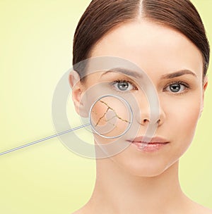 Woman face with dry dehydrated skin