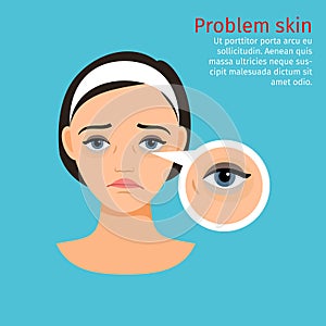Woman face problem eye black circles