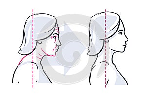 Woman face profile before after skin vector illustration