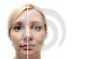 Woman face with wrinkles and age change before and after treatment - the result of rejuvenating cosmetological procedures of