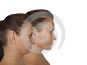 Woman face wrinkles sagging tightening before and after correction treatment, double chin