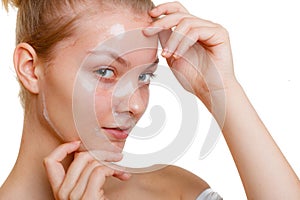 Woman in facial peel off mask.