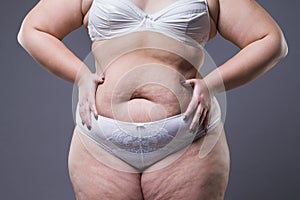 Woman with fat abdomen, overweight female stomach