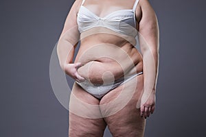 Woman with fat abdomen, overweight female stomach