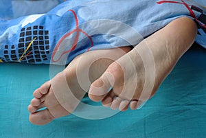 Woman feet with callus photo