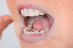 Woman flossing teeth