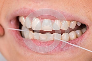 Woman flossing teeth