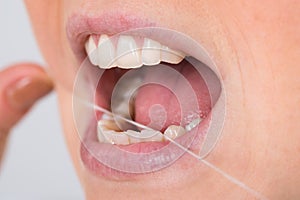 Woman flossing teeth photo