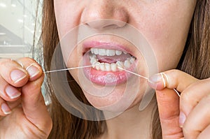 Woman flossing teeth with dental floss