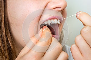 Woman flossing teeth with dental floss