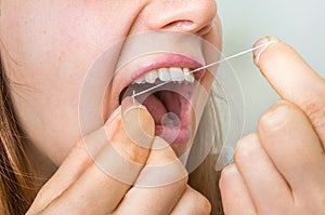 Woman flossing teeth with dental floss