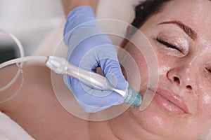 Woman getting facial hydra microdermabrasion at beauty salon