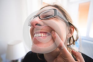 Woman gingivitis show gums teeth