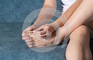 A woman glues a plaster for the treatment of calluses and calluses to her toe. Close-up