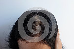 Woman gray hair roots