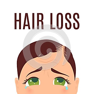 Woman with hair loss problem.