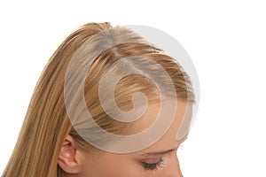 Woman with hair loss problem on white background, closeup. Trichology treatment