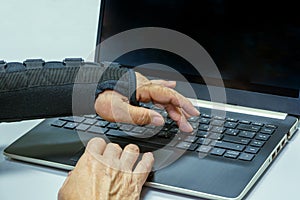 Woman hand in black orthosis is working on computer. A freelancer with one broken wrist typing on laptop computer on keyboard