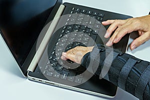 Woman hand in black orthosis is working on computer. A freelancer with one broken wrist typing on laptop computer on keyboard