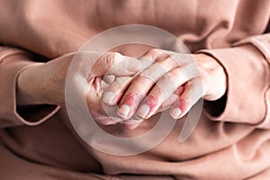 Woman hands with atopic dermatitis, eczema, allergy reaction on skin