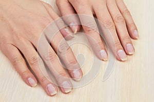 Woman hands after removing gel.