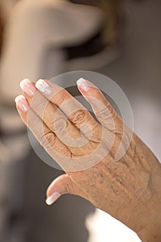 Woman hands with rheumatism arthritis and skin blemishes