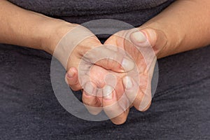 Woman hands showing numb hand photo