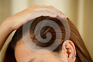 A woman has problems with hair and scalp