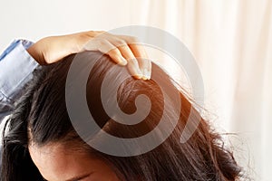 A woman has problems with hair and scalp