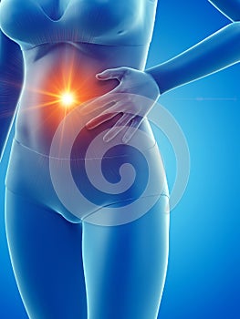 A woman having a bellyache photo