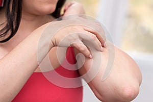 Woman having itchy and scratching her arm