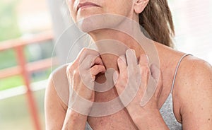 Woman having itchy and scratching her arm