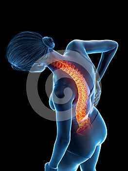 A woman having a painful back