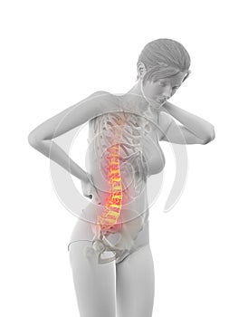 woman having a painful back