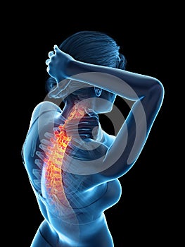 A woman having a painful neck