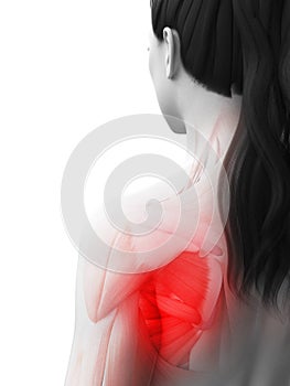 A woman having a painful shoulder