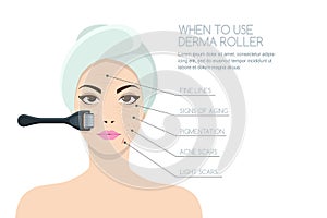 Woman having rejuvenating derma roller therapy. Vector infographics design.