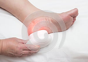 Woman heals heel spur with magnetic field, physiotherapy, magnet treatment, close-up, white background, fascia