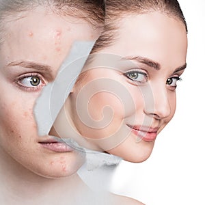 Woman with healthy skin looking from hole in old photo.