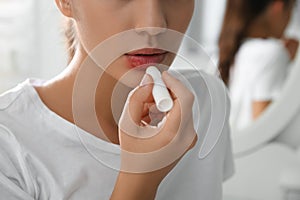 Woman with herpes applying lip balm against blurred background, closeup