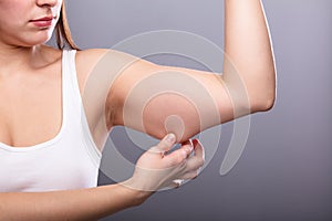 Woman Holding Arm With Excess Fat photo
